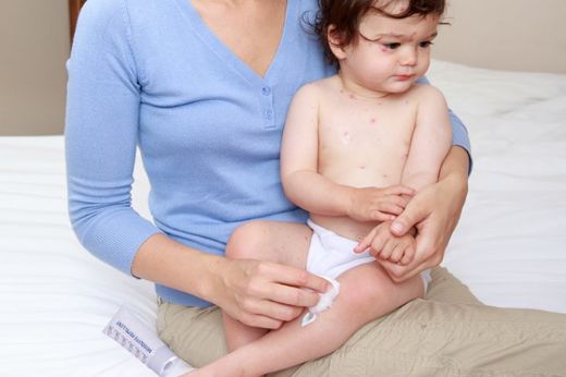 Bebek Sinek Kovucu Kullanımı ve Faydaları Nelerdir?